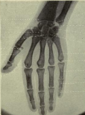 "X-Ray images" (1920)